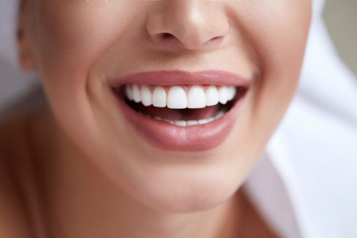 Zirkonyum ve Laminate 3 Antalya Zirkonyum Diş